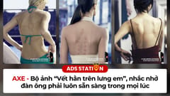 AXE - bộ ảnh vết hằn trên lưng em, nhắc nhở đàn ông phải luôn sẵn sàng mọi lúc